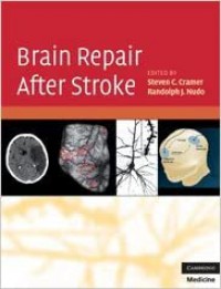 Image of Brain repair after stroke
