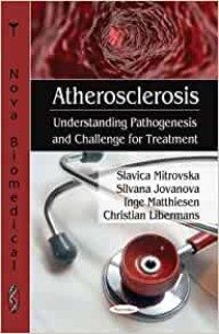 Image of Atherosclerosis: understanding pathogenesis and challenge for treatment